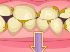 Jwèt Bad Teeth Makeover sou entènèt