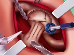Jwèt Princess Hips Surgery sou entènèt