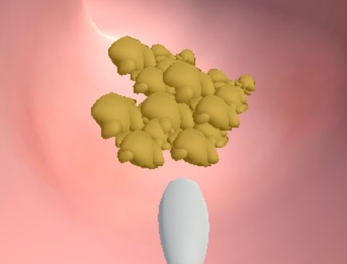 Jwèt Klinik Earwax  sou entènèt